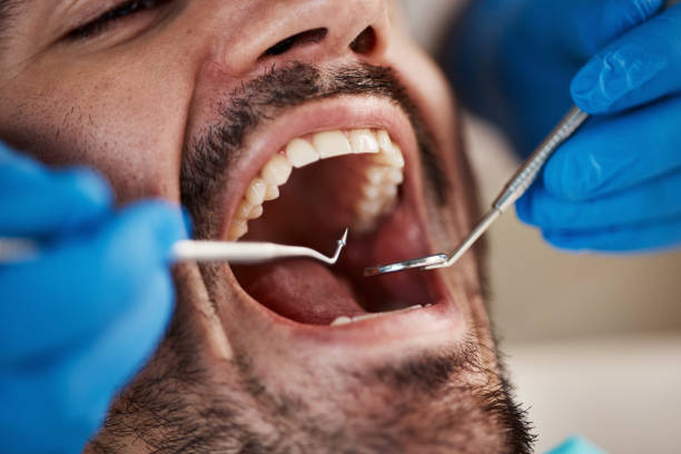 Best Walk-In Emergency Dentist in Joanna, SC