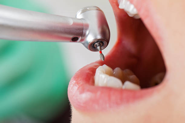 Best Pediatric Emergency Dentist in Joanna, SC